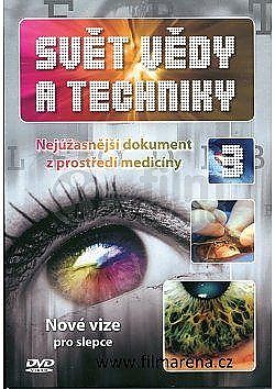 Svět vědy a techniky 3 - Nové vize pro slepce DVD